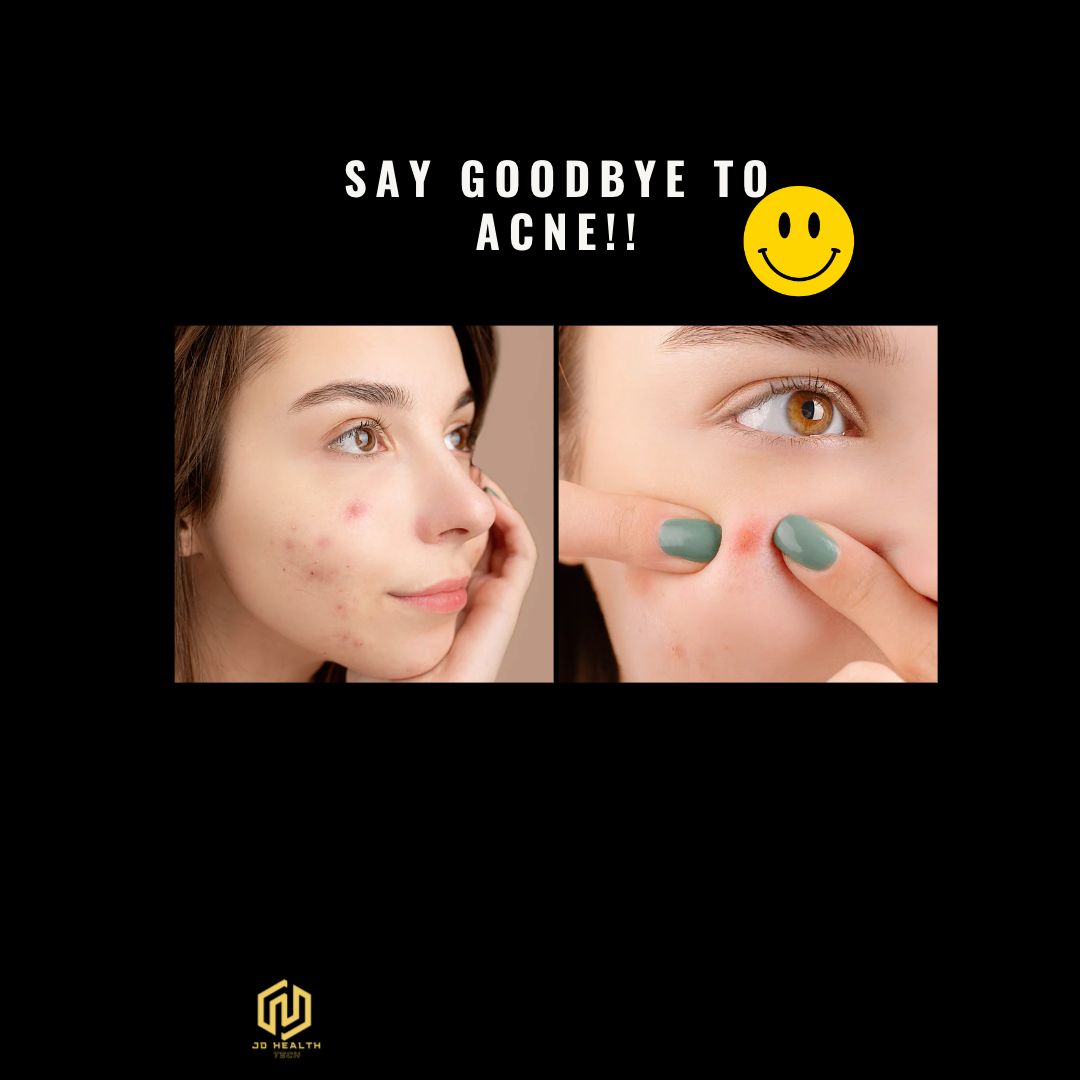 No More Acne: LED Light Therapy Masks Are Changing the Game - jdhealthtech