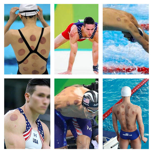 Athletes with cupping therapy marks on their bodies